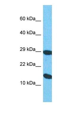 CBT1 / SDHD Antibody (N-Terminus)
