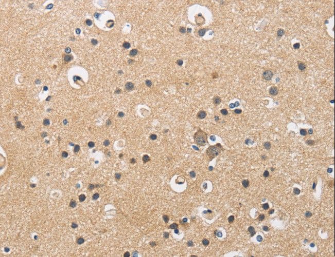 Polyclonal Rabbit anti-Human CKMT2 Antibody (IHC, WB)