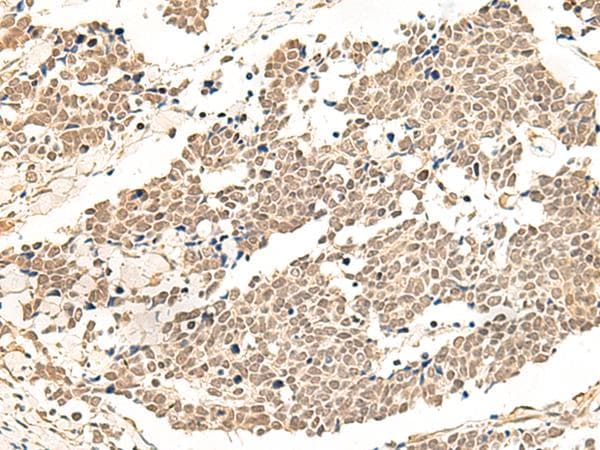 GPR139 Antibody
