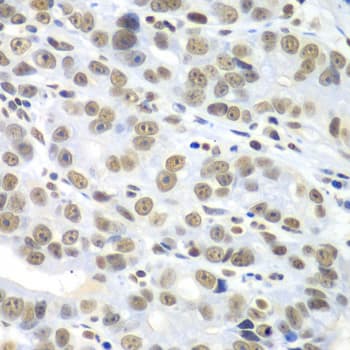 Polyclonal Rabbit anti-Human HDAC2 Antibody (IHC, IF, WB)