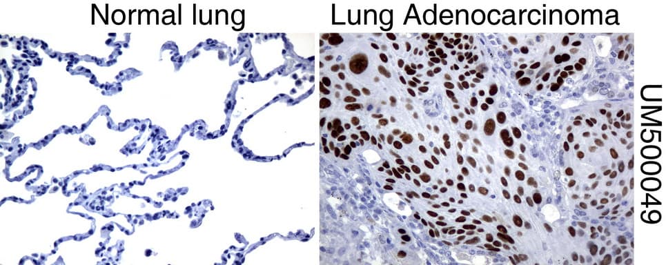 TP53 / p53 Antibody (clone UMAB55, Carrier-free)