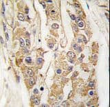 MAP3K8 / TPL2 Antibody (aa368-397)