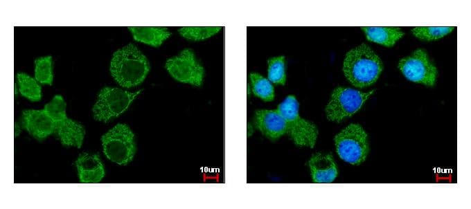IPO7 / RANBP7 Antibody (aa976-1038)