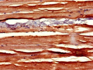Polyclonal Rabbit anti-Human SLIT3 Antibody (IHC)