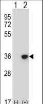 BP1 / DLX4 Antibody (aa72-100)