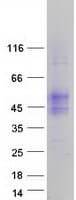 Human TMIGD2 Protein (Recombinant Myc-DDK (Flag))