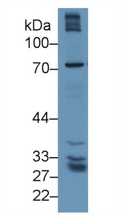 GGTLA1 / GGT5 Antibody (aa388-586, APC)