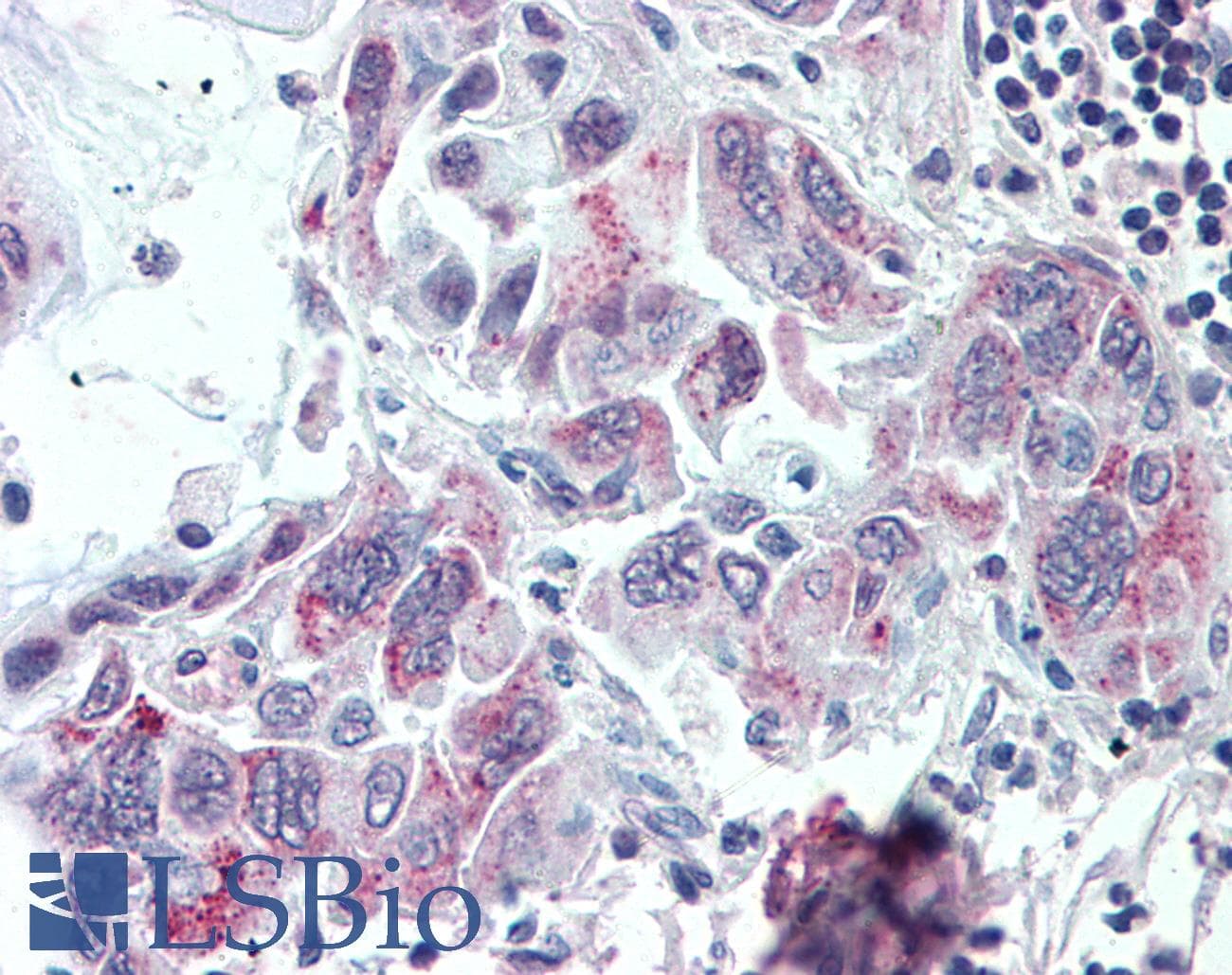 IHC-plus™ TMPRSS4 Antibody (Internal)