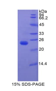 Mouse IGFBP6 Protein (Recombinant His-T7)