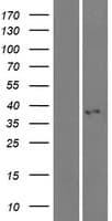 KCTD7 Protein (Over-Expression Lysate Myc-DDK (Flag))