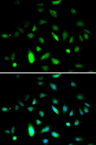 CCNB1 / Cyclin B1 Antibody
