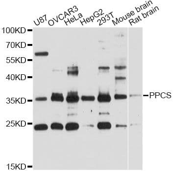 Polyclonal Rabbit anti-Human PPCS Antibody (WB)