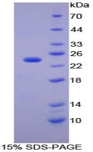 Mouse CA1 / Carbonic Anhydrase I Protein (Recombinant 6His, N-terminus)