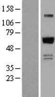 ZNF307 Protein (Over-Expression Lysate Myc-DDK (Flag))