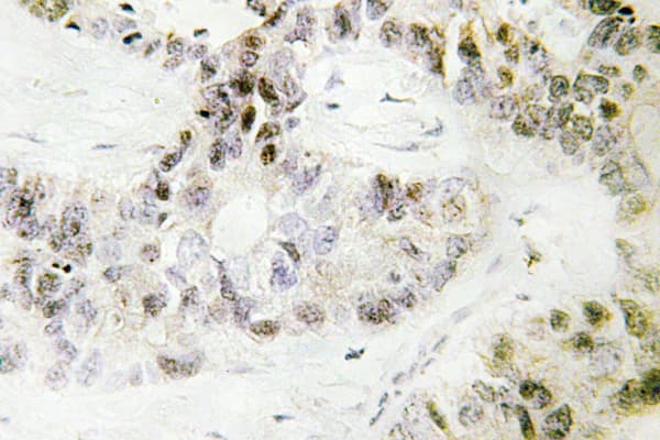PITX1 Antibody (Glu130)