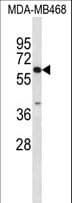 Carboxylesterase 5A / CES5A Antibody (aa244-270)