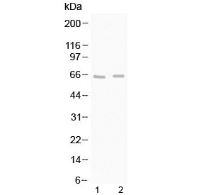 GAD65 Antibody