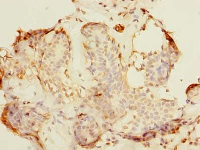 Polyclonal Rabbit anti-Human ALS2CR1 / NIF3L1 Antibody (IHC, WB)