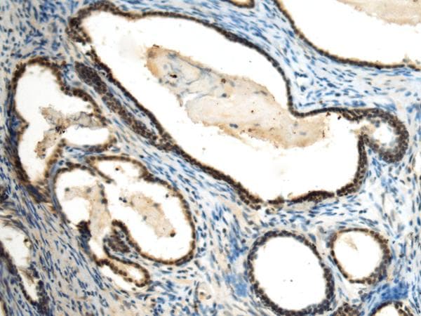 SUV39H2 Antibody
