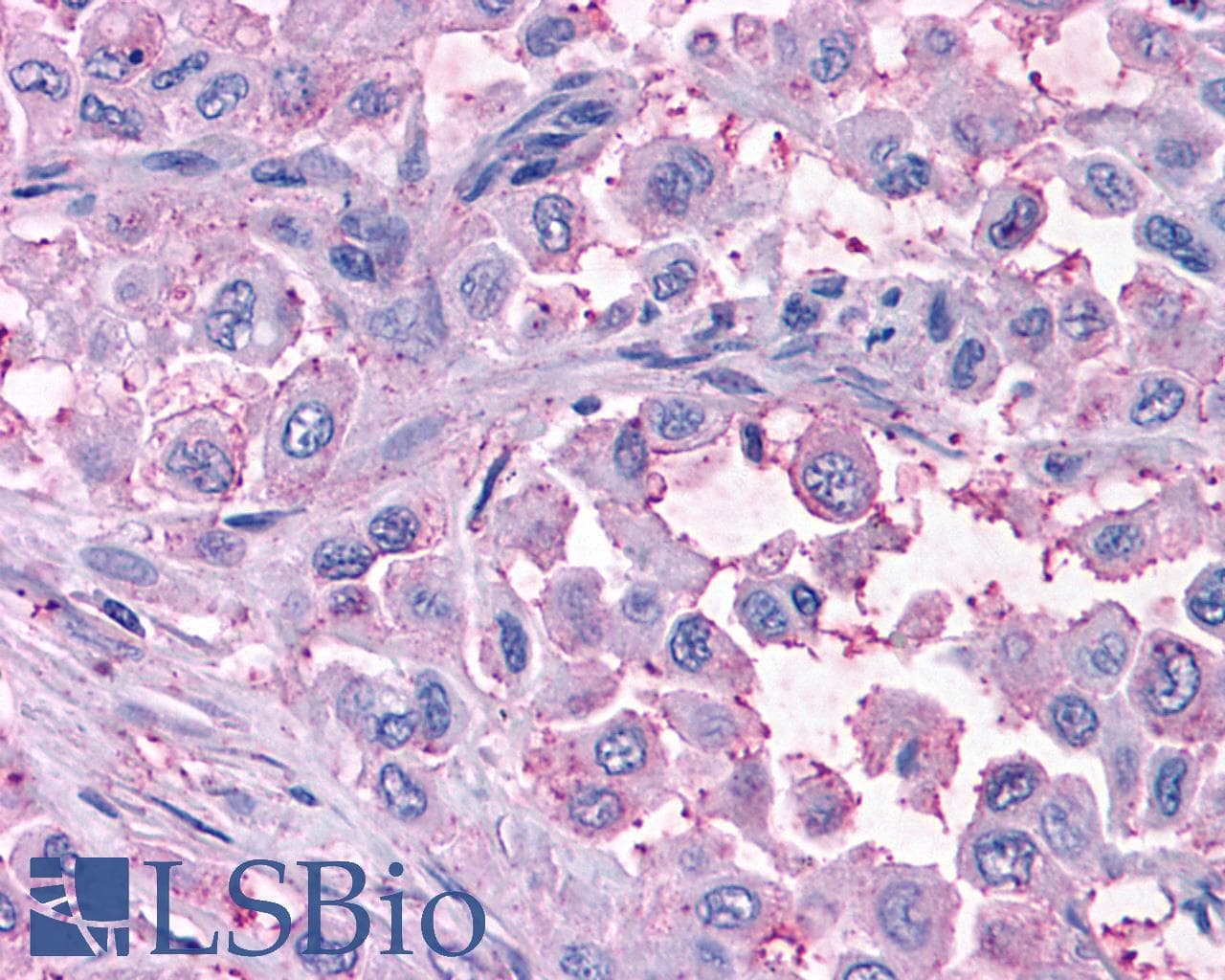 PathPlus™ Polyclonal Rabbit anti-Human MAS1 / MAS Antibody (C-Terminus, IHC)