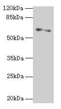 IHC-plus™ Polyclonal Rabbit anti-Human SLC1A6 / EAAT4 Antibody (IHC, WB)