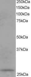 IHC-plus™ Polyclonal Goat anti-Human DCXR Antibody (aa232-244, IHC, WB)