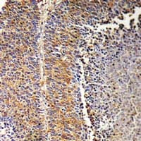 SH2D2A Antibody (Internal)