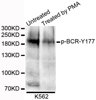 CML / BCR Antibody (phospho-Tyr177)