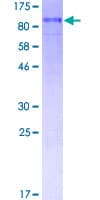 Human FAK / Focal Adhesion Kinase Protein (Recombinant GST)