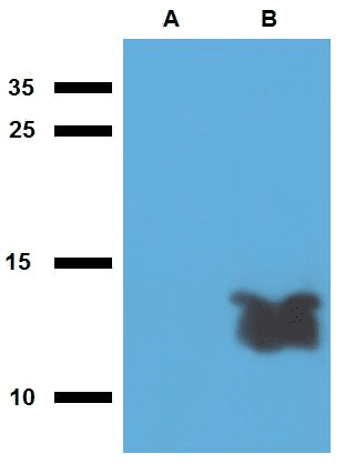 Mycobacterium tuberculosis Tb7.7 Antibody (clone Polyclonal)