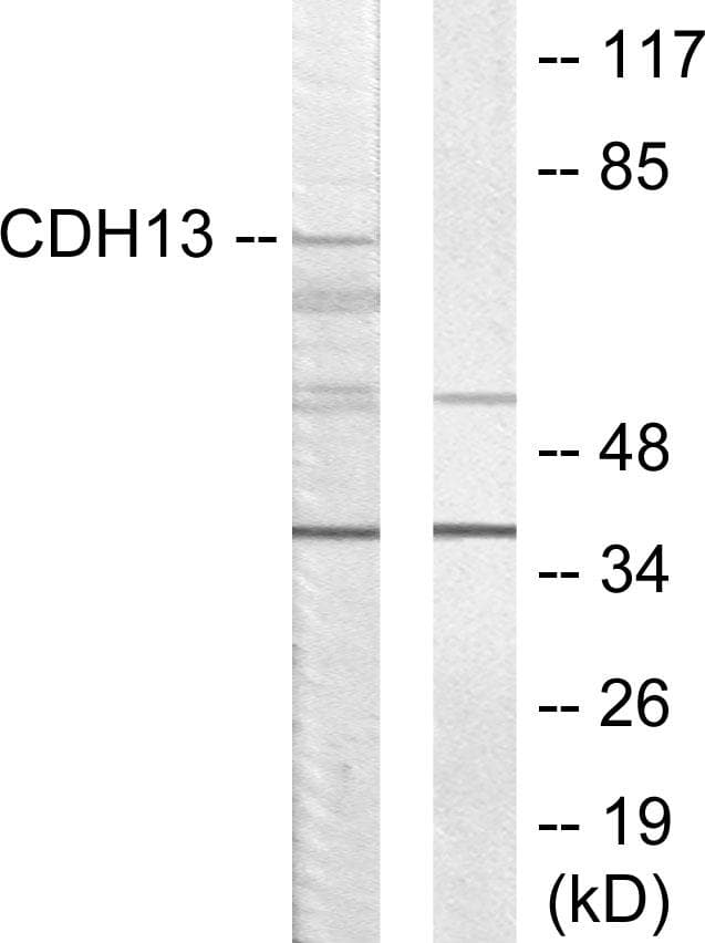 CDH13 / Cadherin 13 Antibody
