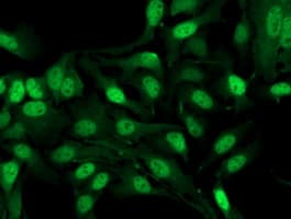 ADH2 / ADH1B Antibody (clone OTI4F12)