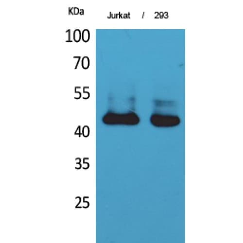 Polyclonal Rabbit anti-Human SERPINB3 Antibody (101-150 aa, Internal, IHC, WB)