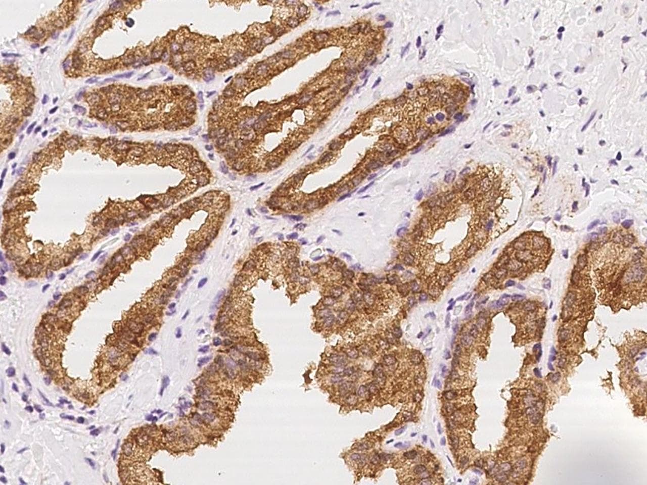 FAM83C Antibody