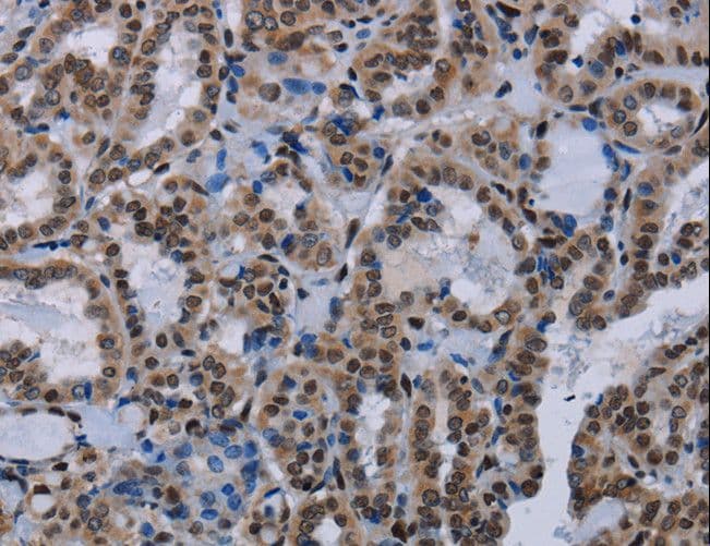 HMG1 / HMGB1 Antibody