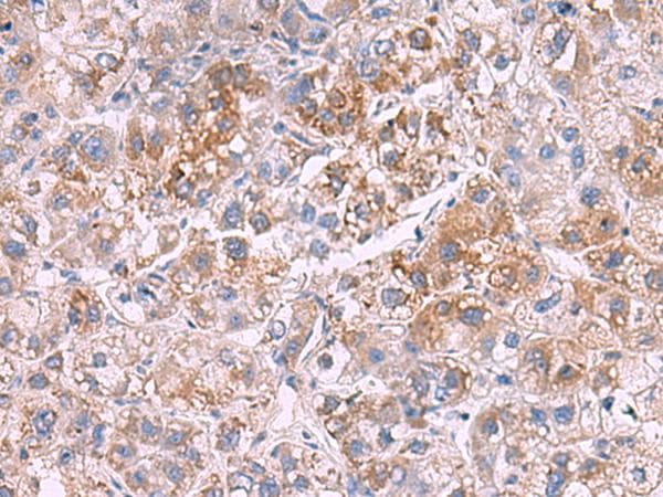 Polyclonal Rabbit anti-Human GSTCD Antibody (IHC, WB)