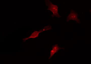 MAP3K7 / TAK1 Antibody (phospho-Thr187)