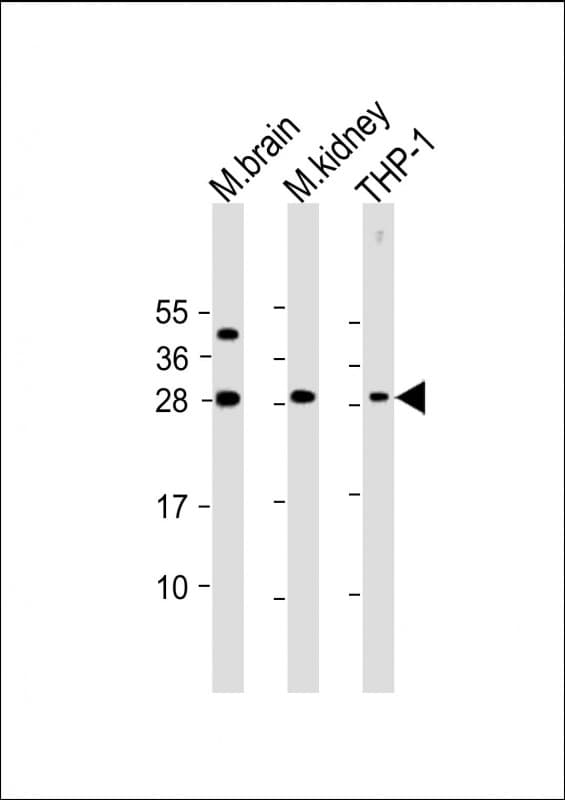 D52 / TPD52 Antibody (N-Terminus)