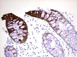 KRT20 / CK20 / Cytokeratin 20 Antibody (clone OTI6G4)
