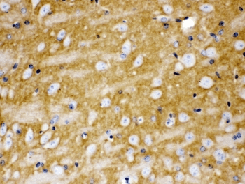 Polyclonal Rabbit anti-Human CD47 Antibody (IHC, IF, WB)