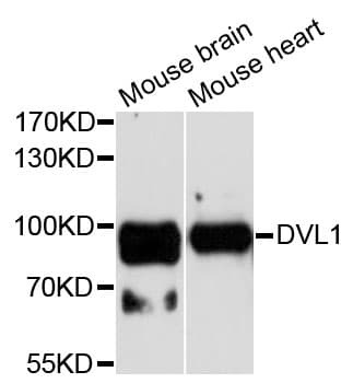 Polyclonal Rabbit anti-Human DVL1 / DVL / Dishevelled Antibody (WB)