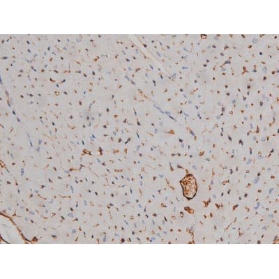 SYN / FYN Antibody (phospho-Tyr530)