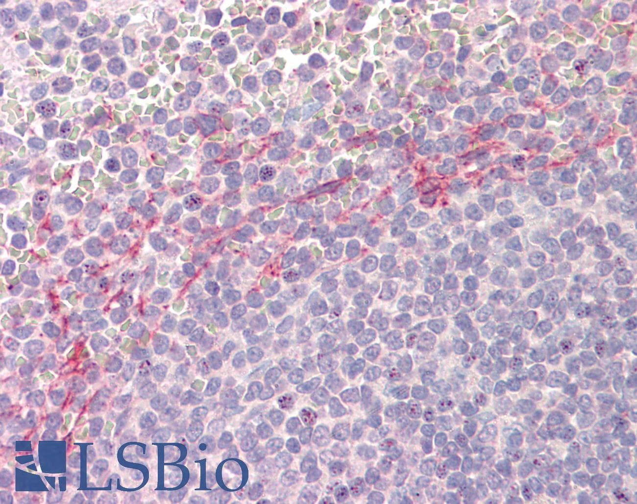 APOBEC3D Antibody (aa61-74)