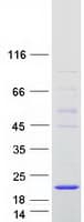 Human ALKBH6 Protein (Recombinant Myc-DDK (Flag))