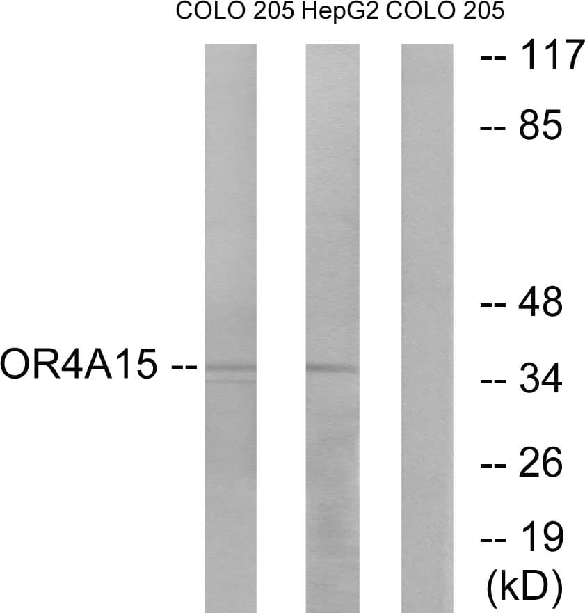 OR4A15 Antibody (aa261-310)