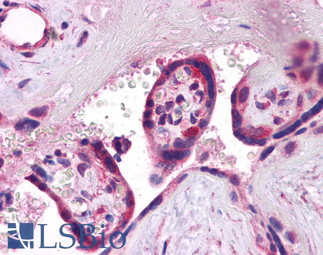 SYNGR3 / Synaptogyrin 3 Antibody