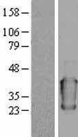 Human ORM1 / Orosomucoid Protein (Over-Expression Lysate Myc-DDK (Flag))