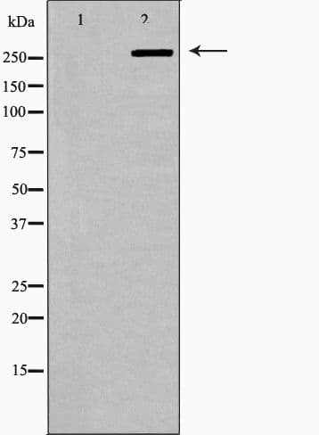 FASN / Fatty Acid Synthase Antibody