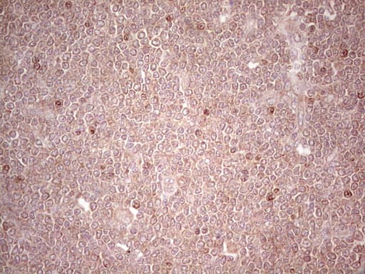 Monoclonal Mouse anti-Human LPIN3 / Lipin-3 Antibody (clone OTI1C9, Carrier-free, IHC)