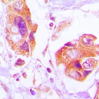 FLNA / Filamin A Antibody (phospho-Ser2152)